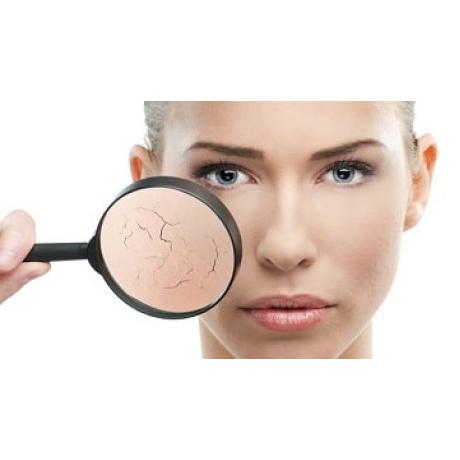 Домашний уход за сухой кожей лица Домашний уход за сухой кожей лица